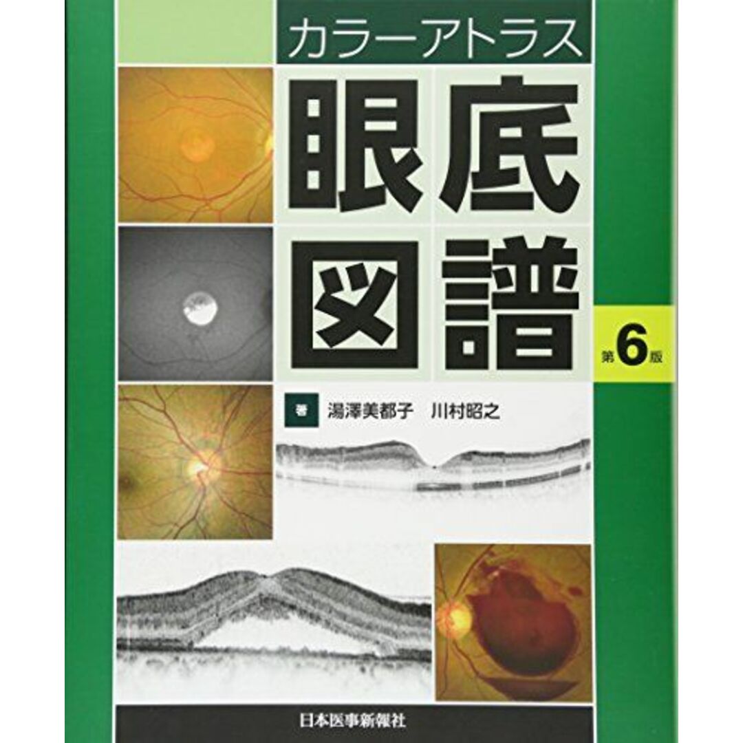 驚きの価格 カラーアトラス 眼底図譜 湯澤美都子; 川村昭之