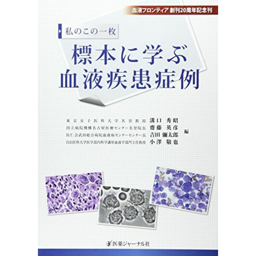【2024最新】SNSで話題・人気の商品のおすすめアイテム 私のこの一枚標本に学ぶ血液疾患症例 秀昭 溝口 語学+参考書