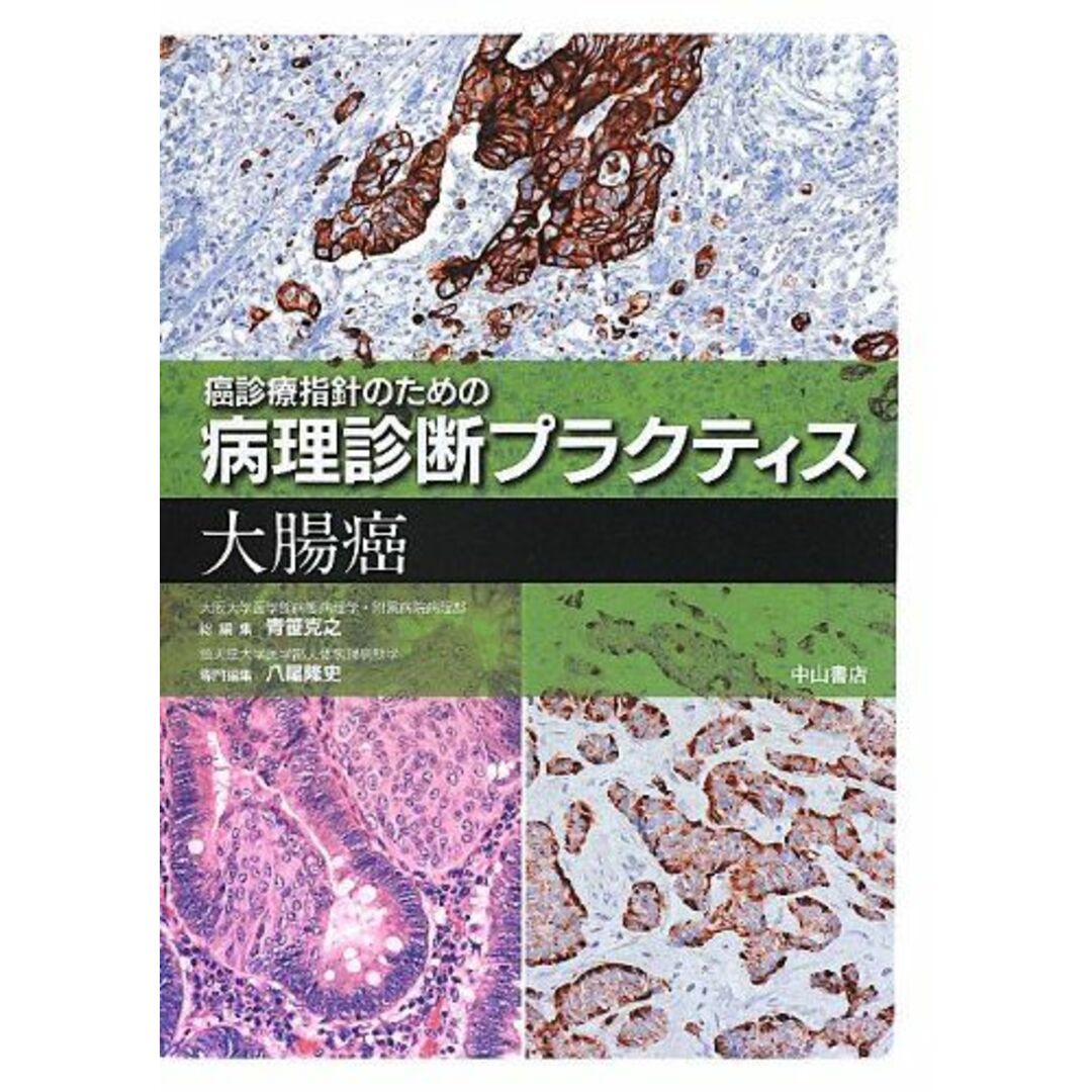 発行年大腸癌 (癌診療指針のための病理診断プラクティス) [単行本] 八尾隆史; 青笹克之