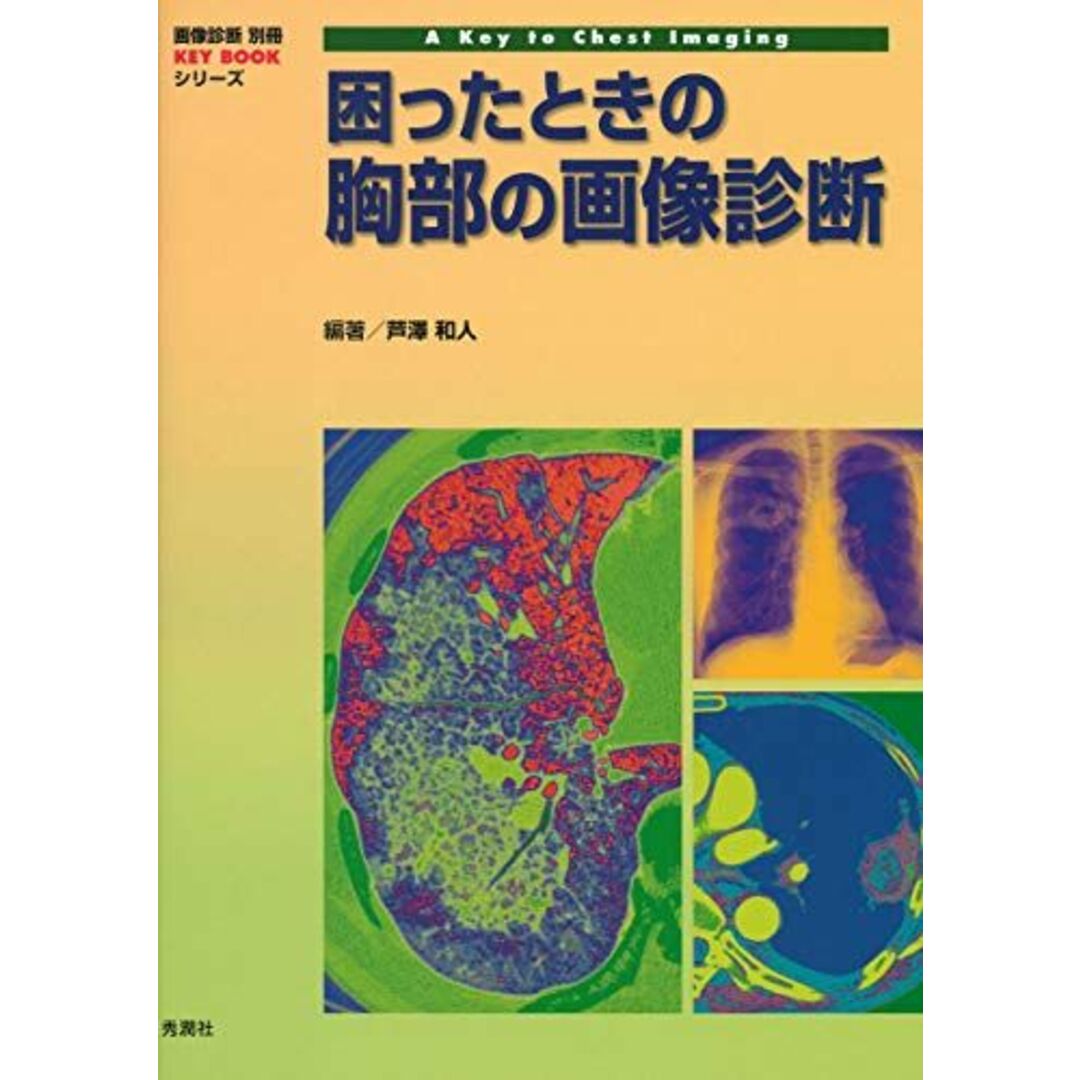 困ったときの胸部の画像診断 (画像診断別冊KEY BOOKシリーズ) [単行本] 芦澤和人