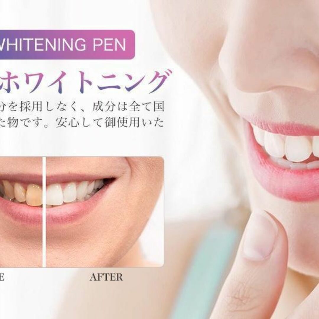 ペン型デンタルホワイト ホワイトニング ペン ジェル 歯を白く 歯磨き 2本