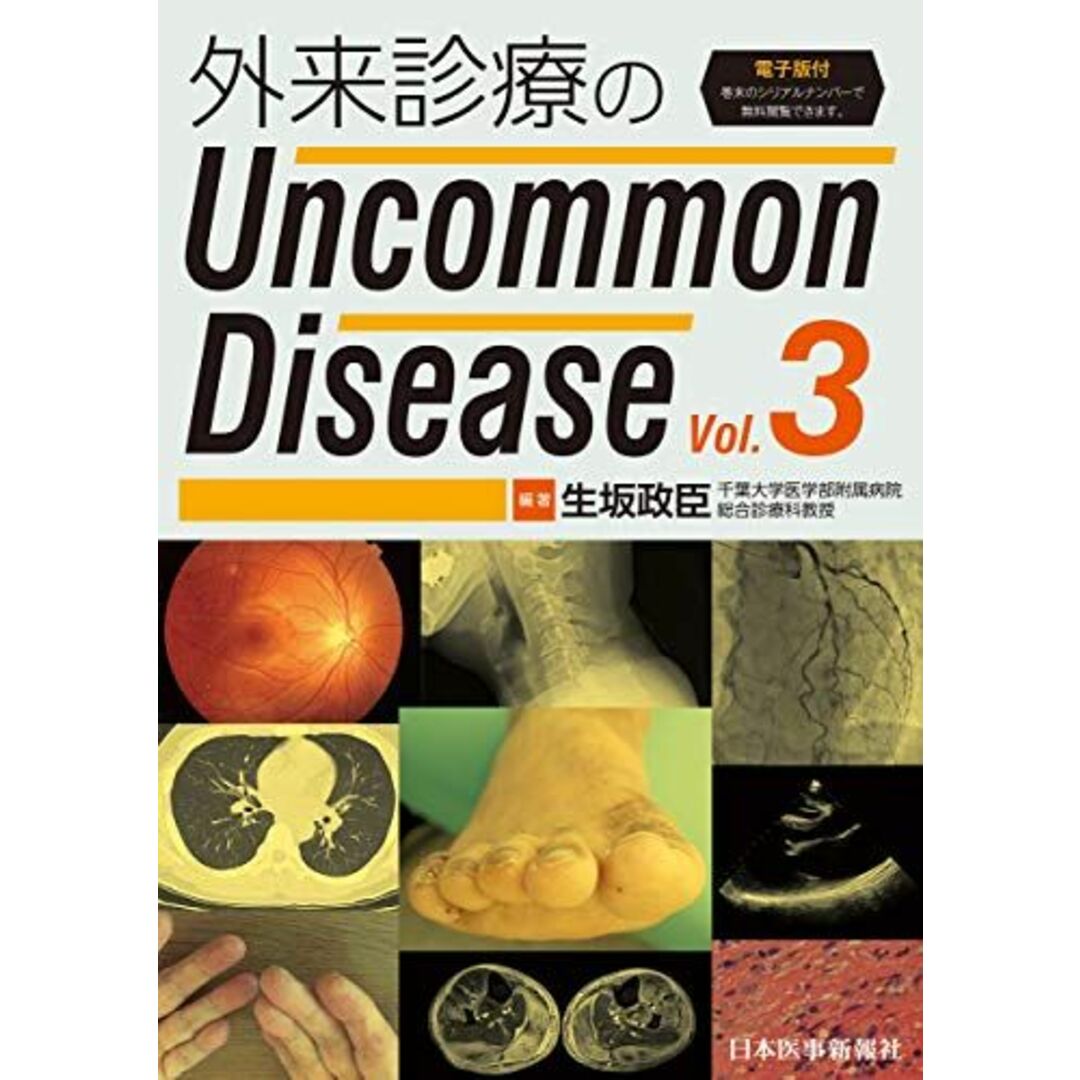外来診療のUncommon Disease vol.3【電子版付】 [単行本（ソフトカバー）] 生坂政臣