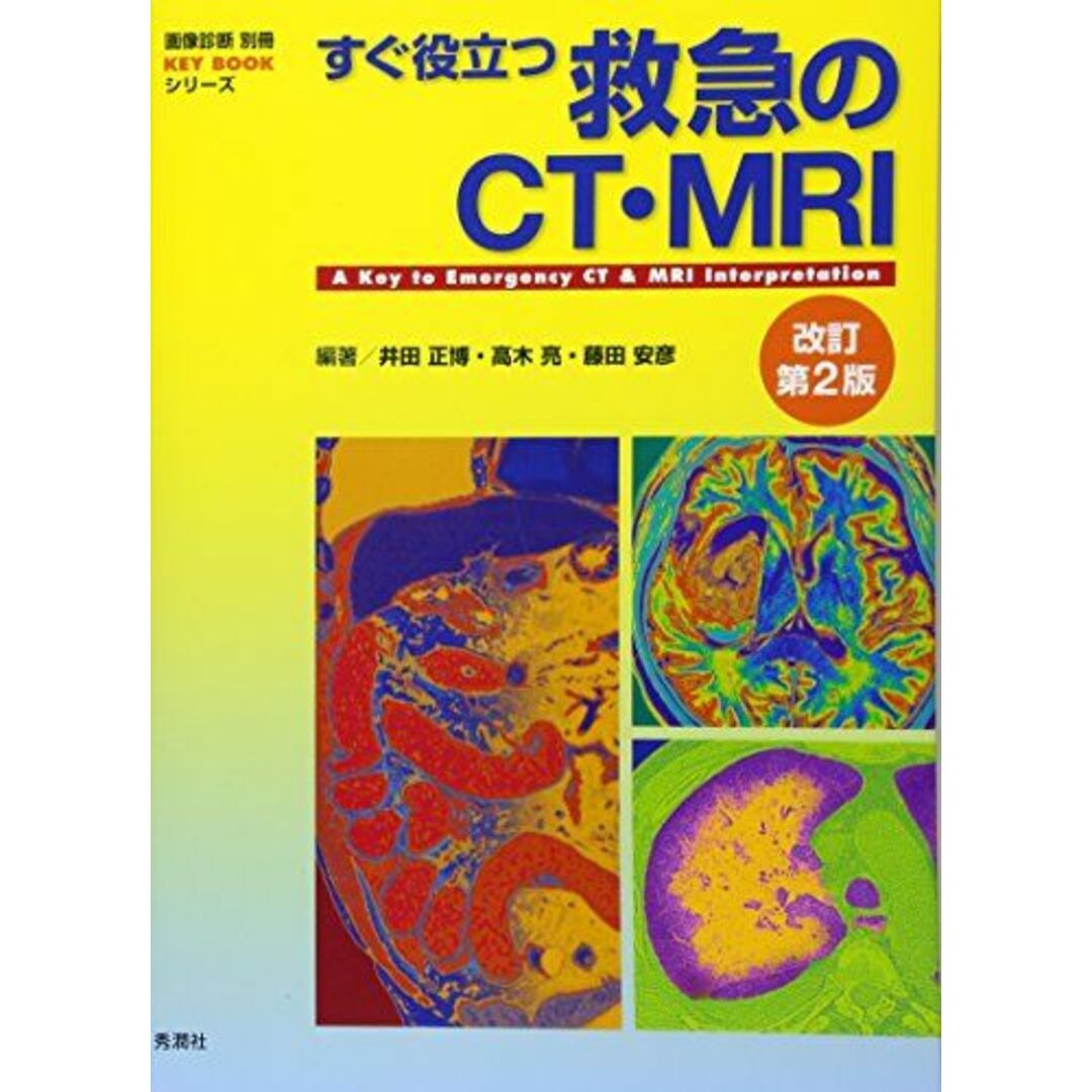 すぐ役立つ救急のCT・MRI 改訂第2版 (画像診断別冊KEY BOOKシリーズ)