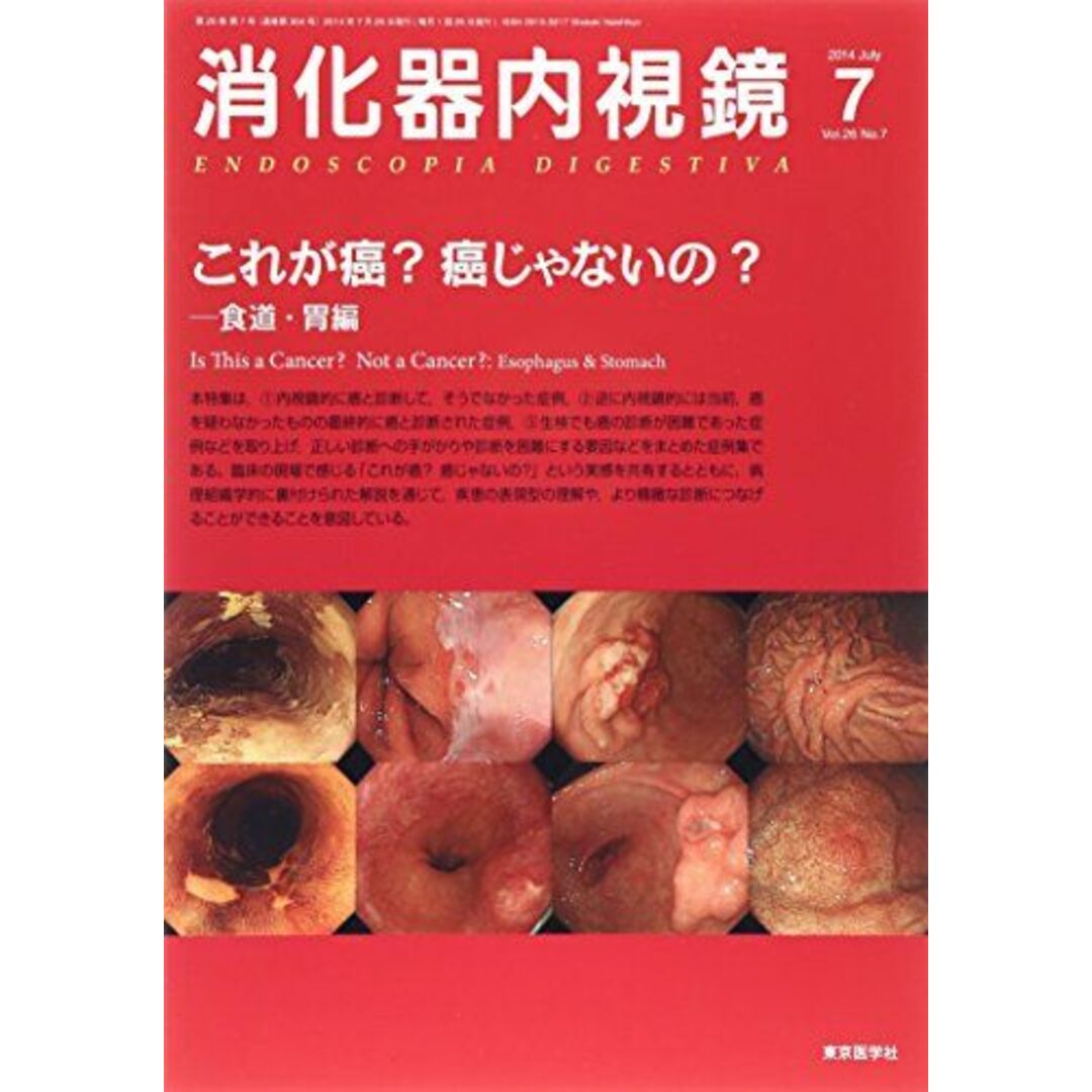 消化器内視鏡 14年7月号 26ー7 これが癌?癌じゃないの? 食道・胃編 [単行本] 消化器内視鏡編集委員会