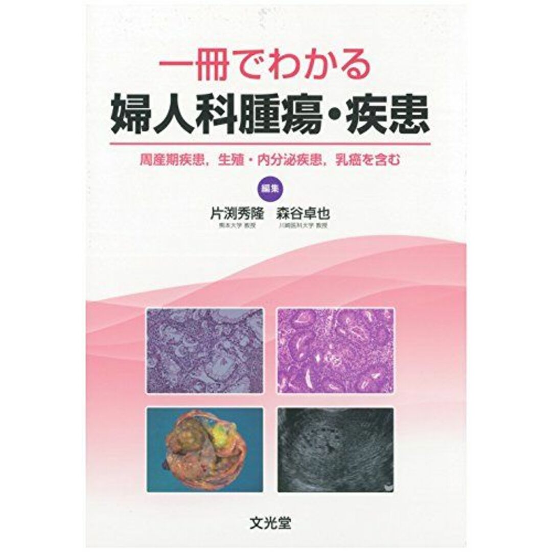 一冊でわかる婦人科腫瘍・疾患 [単行本] 片渕秀隆; 森谷卓也