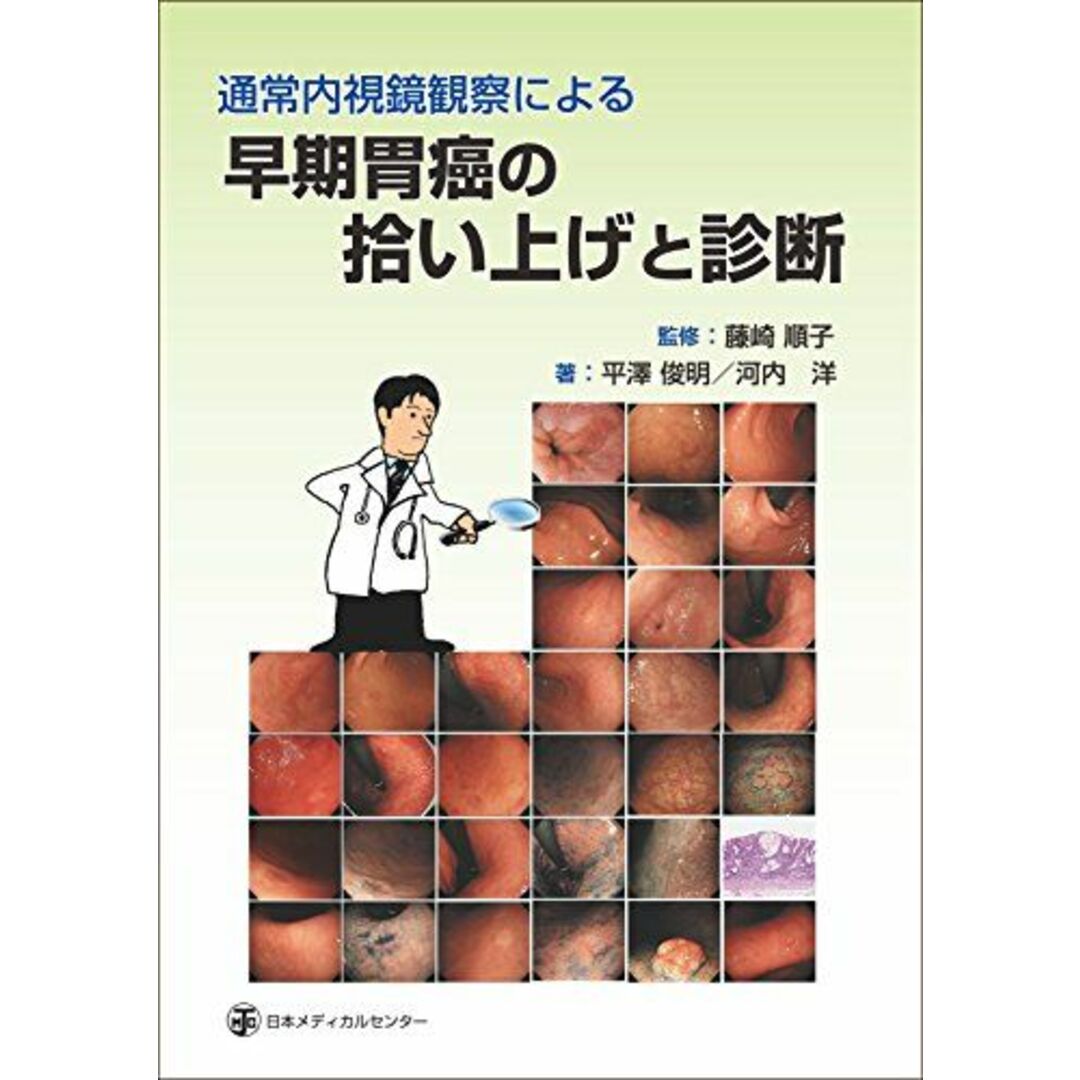 通常内視鏡観察による早期胃癌の拾い上げと診断 [単行本] 平澤 俊明、 河内 洋; 藤崎 順子