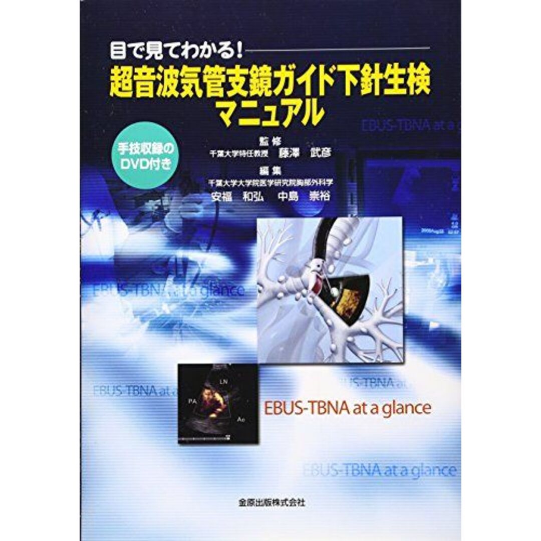 目で見てわかる!超音波気管支鏡ガイド下針生検マニュアル [単行本] 武彦， 藤澤、 和弘， 安福; 崇裕， 中島