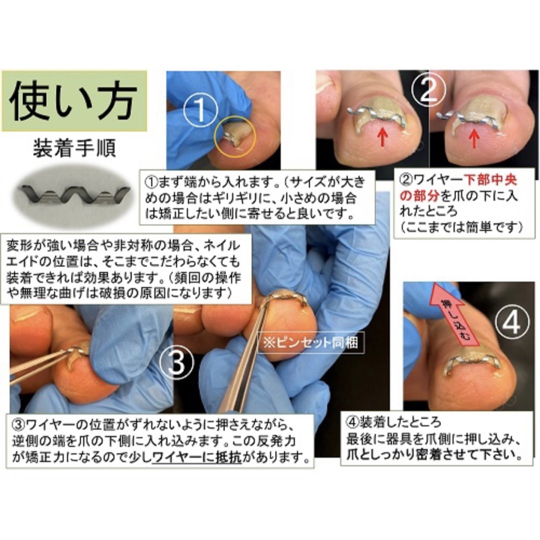 巻き爪 矯正、新品未使用品、ネイル・エイド 16mm、ワイヤー クリップ 1