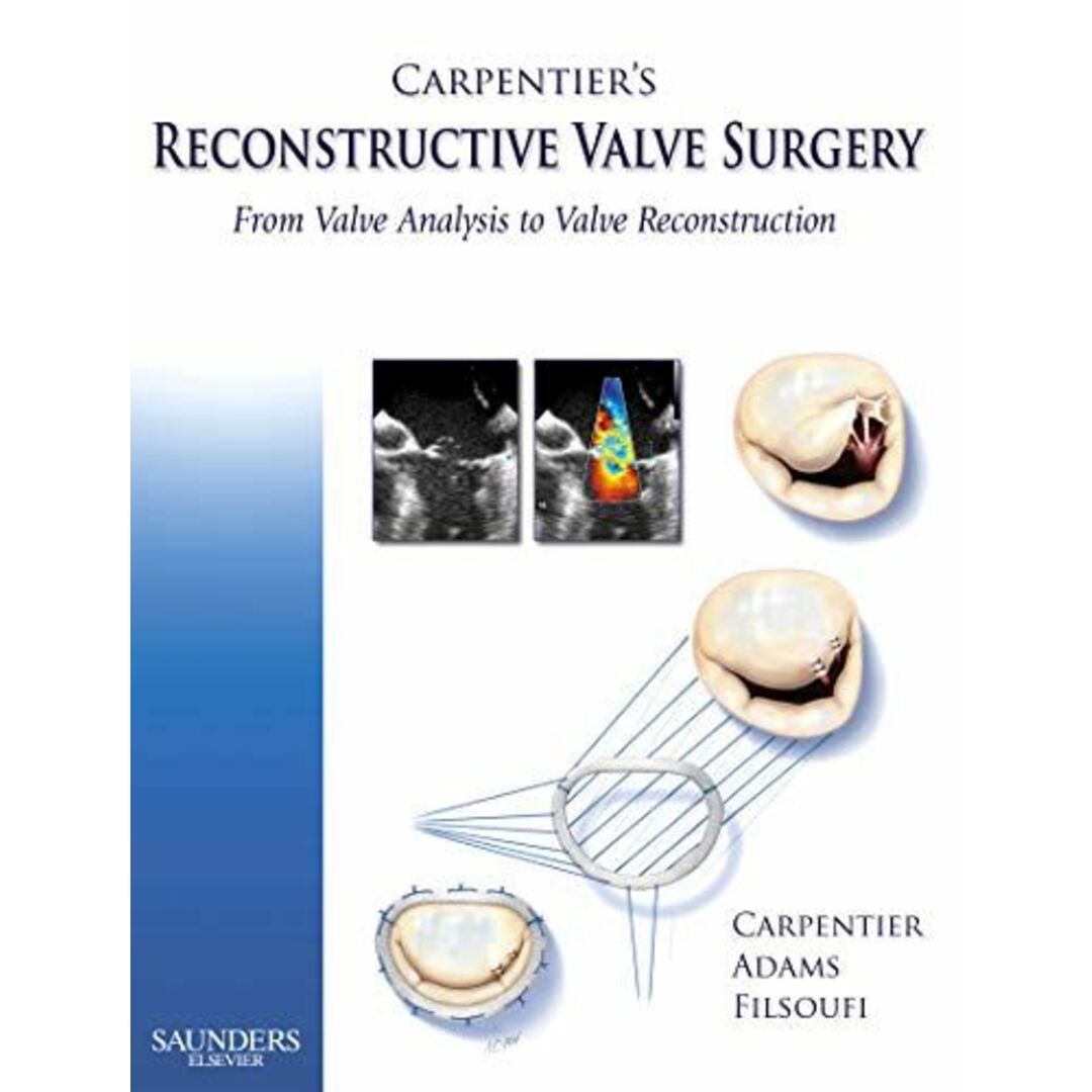 Carpentier's Reconstructive Valve Surgery， 1e [ハードカバー] Carpentier MD  PhD， Alain、 Adams MD， David H.; Filsoufi MD， FarzanISBN13