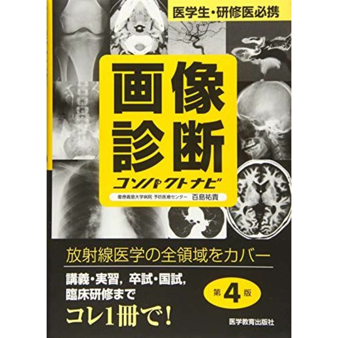 画像診断コンパクトナビ―医学生・研修医必携 (コンパクトナビシリース) 百島 祐貴 エンタメ/ホビーの本(語学/参考書)の商品写真