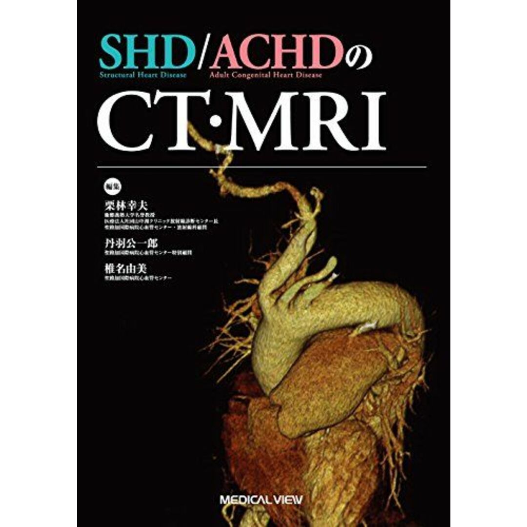 SHD/ACHDのCT・MRI