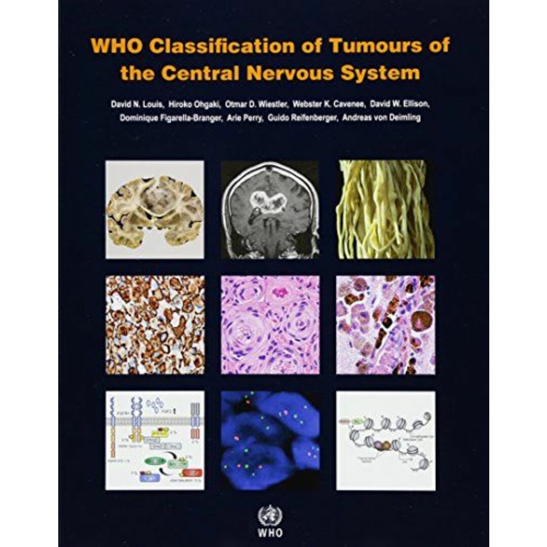 WHO Classification of Tumours of the Central Nervous System (WHO Health Organization Classification of Tumours) [ペーパーバック] International Agency for Research on Cancer、 Louis，David N.、 Ohgaki，Hiroko、 Wi