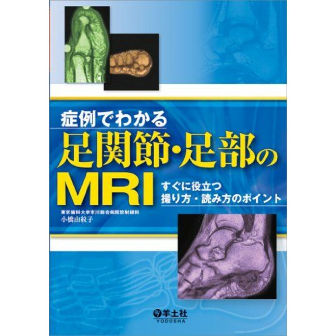 症例でわかる足関節・足部のMRI?すぐに役立つ撮り方・読み方のポイント