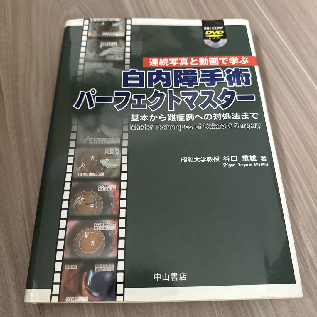 基本から難症例への対処法まで　白内障手術パ－フェクトマスタ－　健康/医学