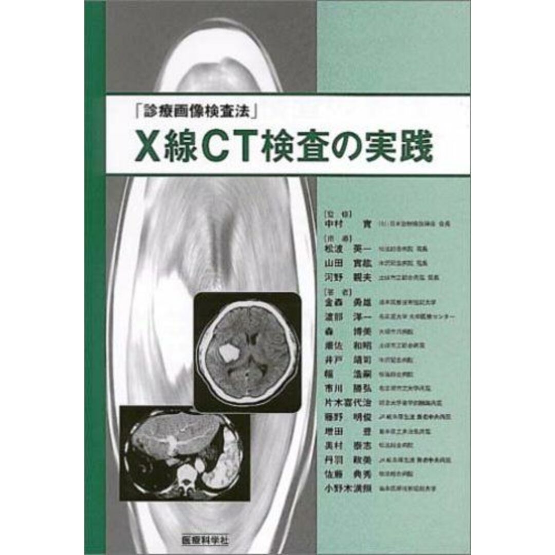 X線CT検査の実践―診療画像検査法 [大型本] 中村 實