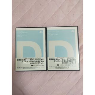 難しい下顎ケースでの正確なピンポイント埋入を可能にする皆川式インプラント