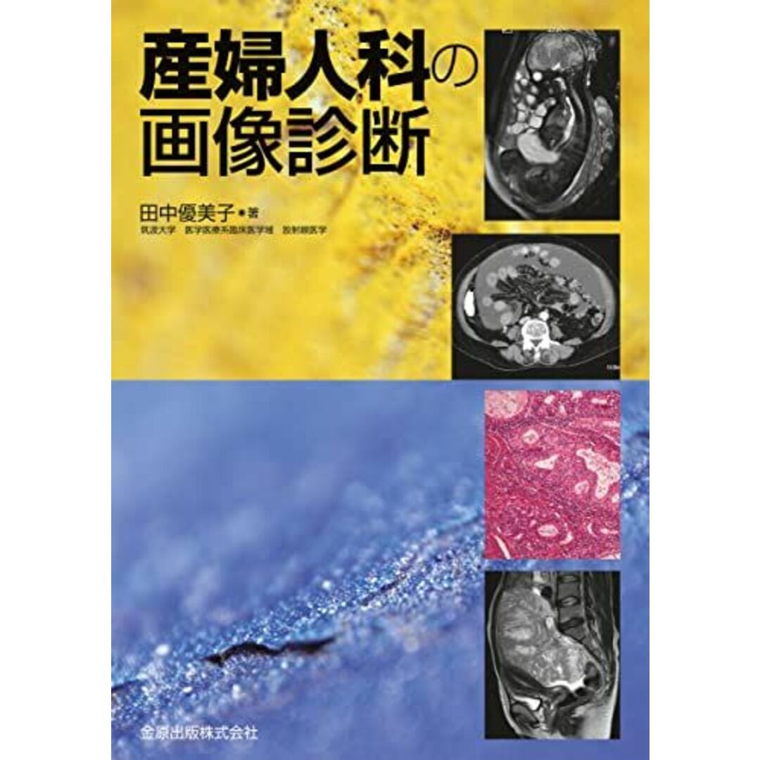 産婦人科の画像診断 [単行本] 田中優美子