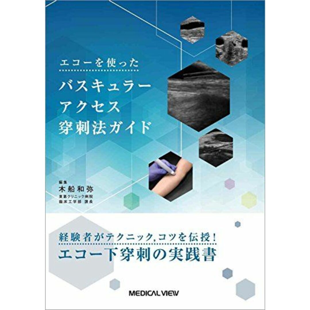 エコーを使ったバスキュラーアクセス穿刺法ガイド [単行本] 木船 和弥