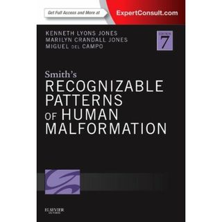 Smith's Recognizable Patterns of Human Malformation: Expert Consult - Online and Print [ハードカバー] Jones MD， Kenneth Lyons、 Jones MD， Marilyn Crandall; del Campo MD  PhD， Miguel(語学/参考書)