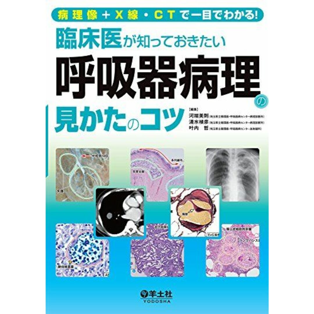 病理像＋X線・CTで一目でわかる！ 臨床医が知っておきたい呼吸器病理の見かたのコツ [単行本] 河端 美則、 清水 禎彦; 叶内 哲