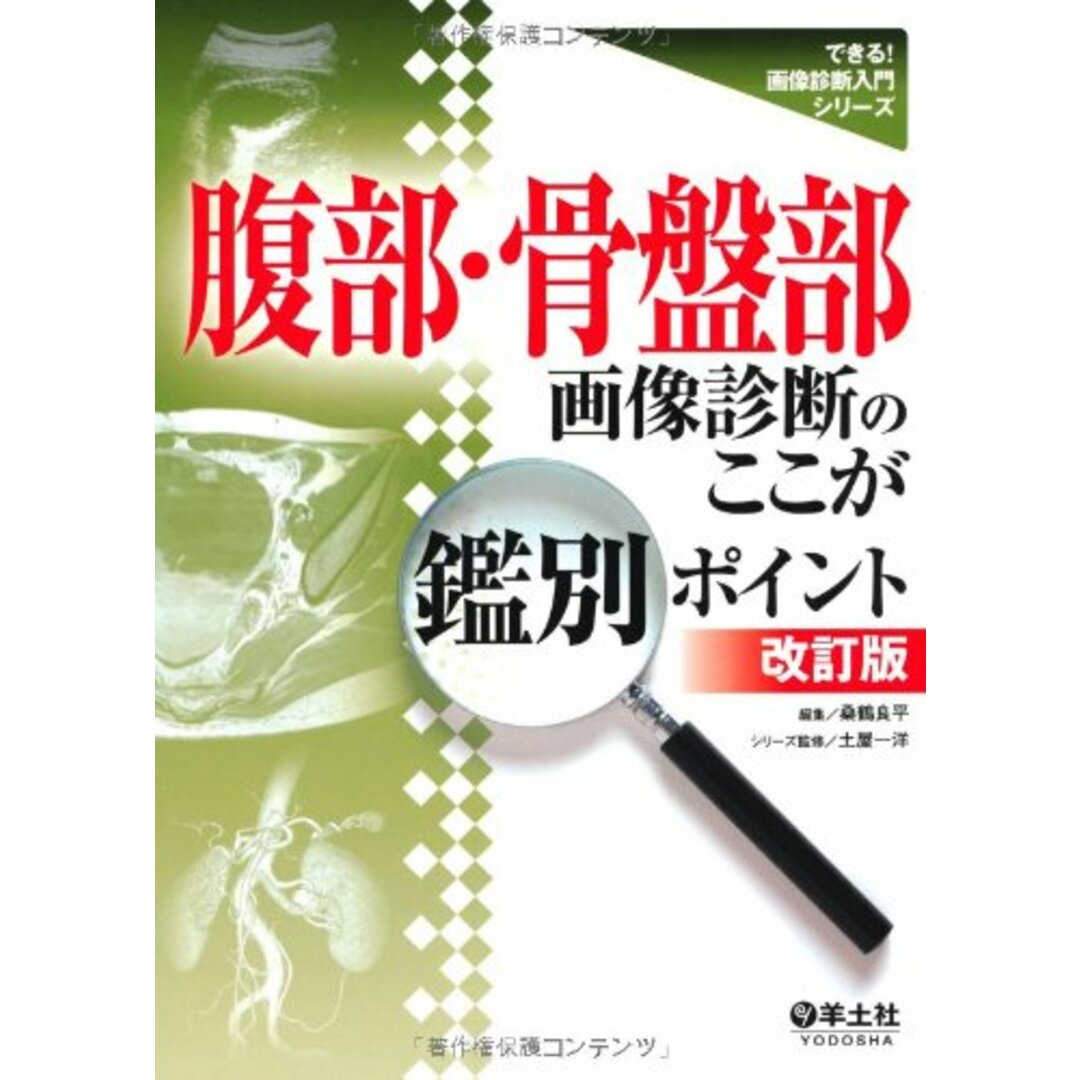 腹部・骨盤部画像診断のここが鑑別ポイント (できる!画像診断入門シリーズ)／桑鶴 良平