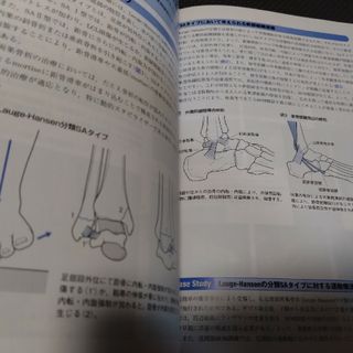 整形外科ナビゲーション上肢下肢2冊セット 送料無料即配送 理学療法士 整形外科ナビゲーション上肢下肢2冊セット 送料無料即配送 理学療法士