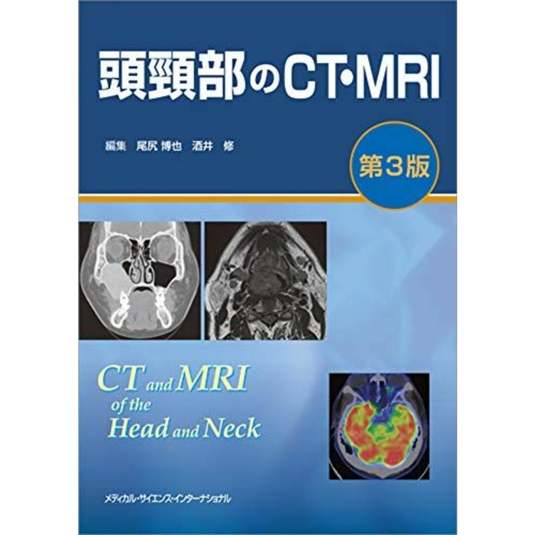 頭頸部のCT・MRI 第3版当社の出品一覧はこちら↓