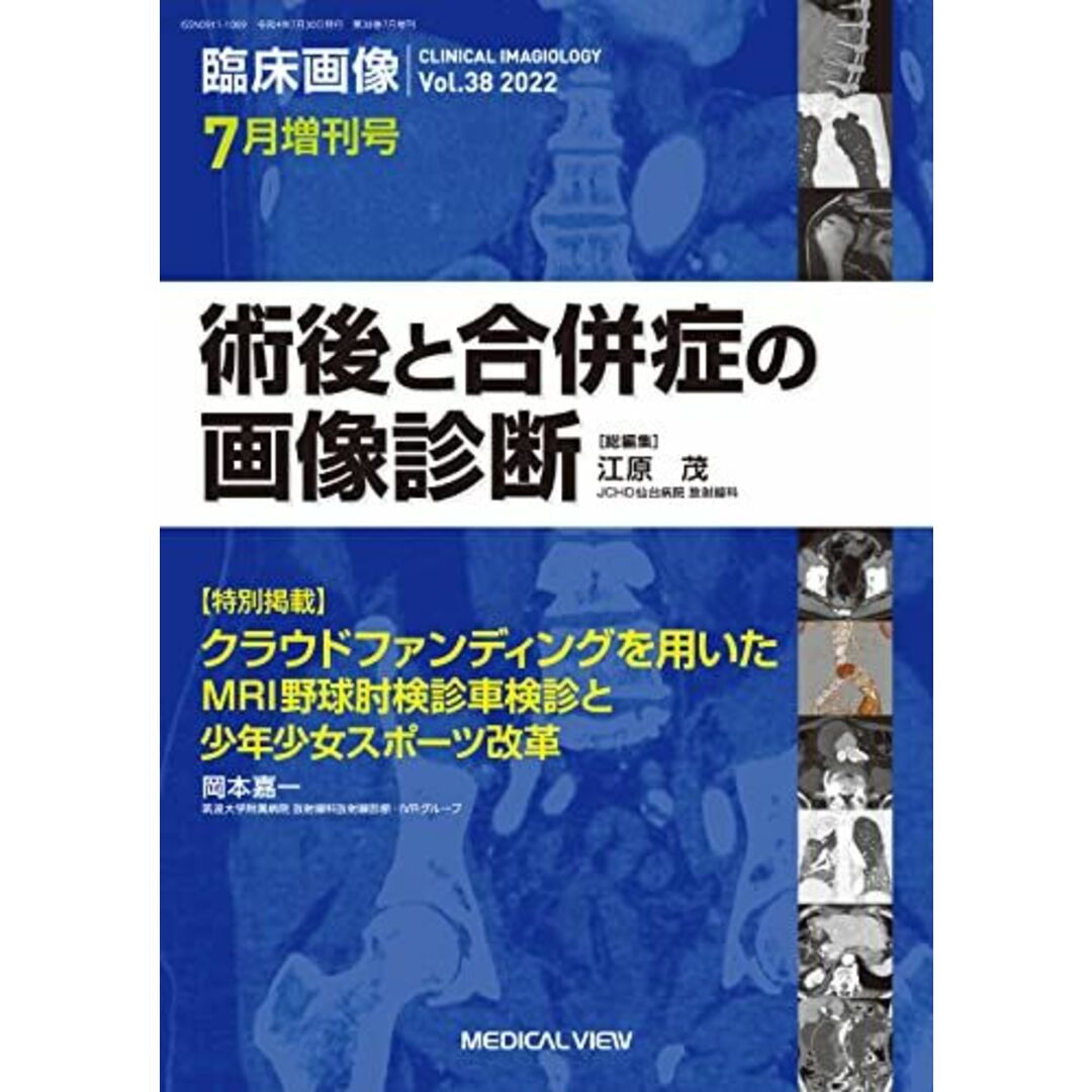 臨床画像 2022年7月増刊号 特集:術後と合併症の画像診断