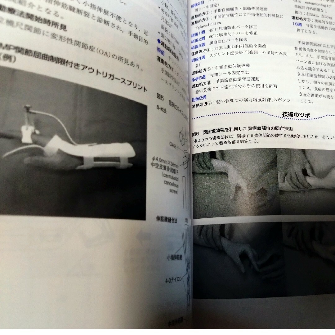 整形外科運動療法ナビゲーション2冊上下肢 理学療法士作業療法士 整形外科運動療法ナビゲーション2冊上下肢 理学療法士作業療法士