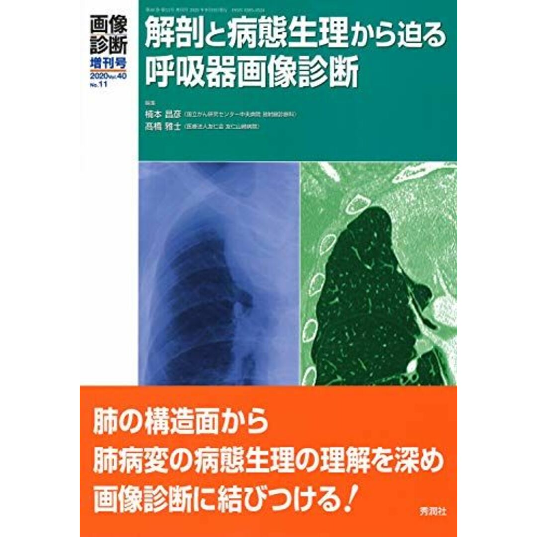 画像診断2020年増刊号(Vol.40 No.11) 解剖と病態生理から迫る呼吸器画像診断 (画像診断増刊号)