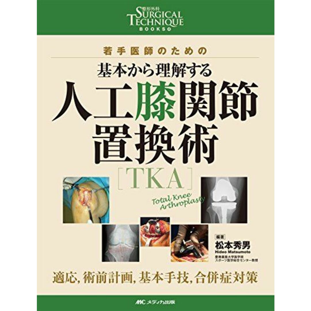 9784840461740人工膝関節置換術[TKA]: 若手医師のための 基本から理解する/適応，術前計画，基本手技，合併症対策 (整形外科SURGICAL TECHNIQUE BOOKS 4) [単行本] 松本 秀男