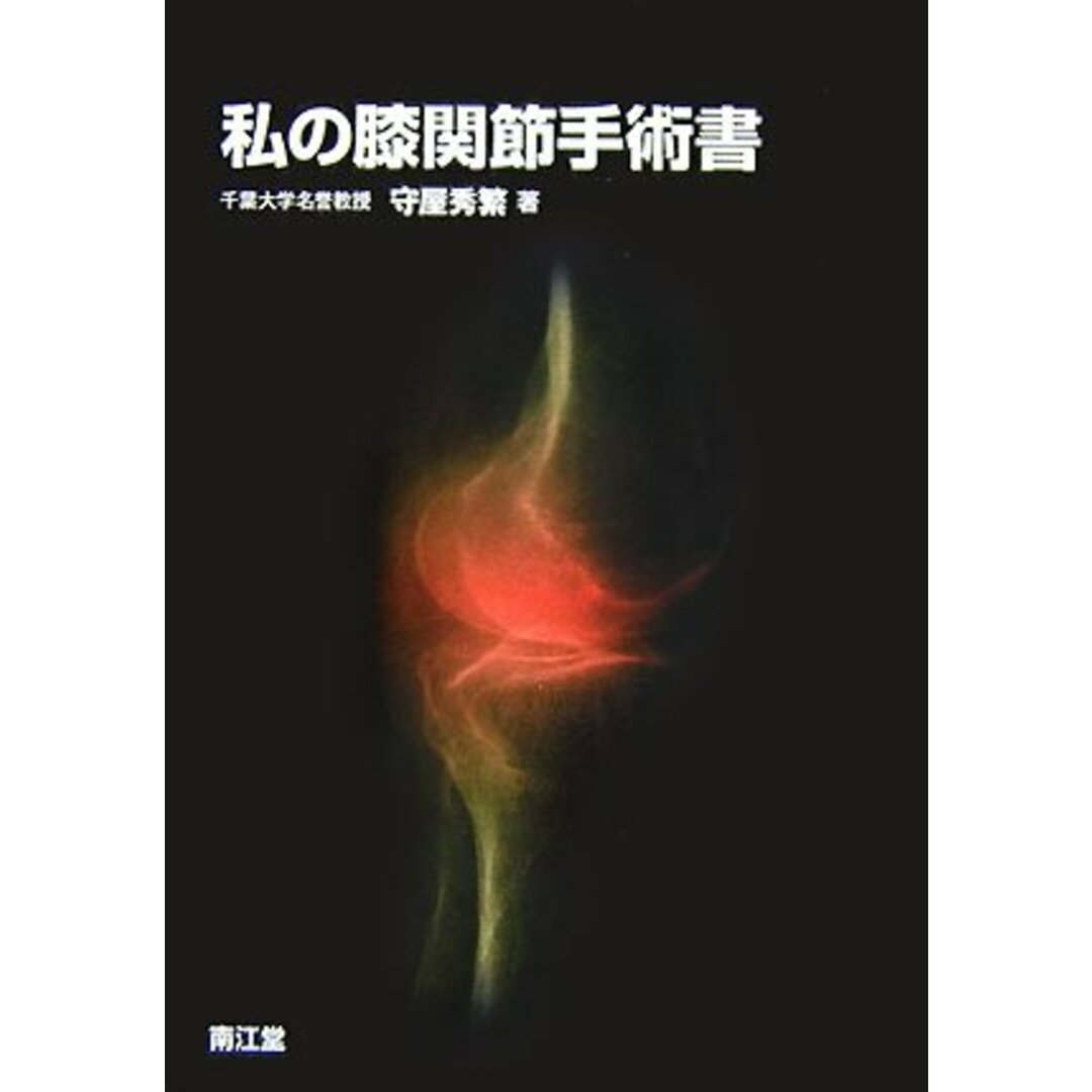 【中古】私の膝関節手術書/守屋 秀繁/南江堂 エンタメ/ホビーの本(その他)の商品写真