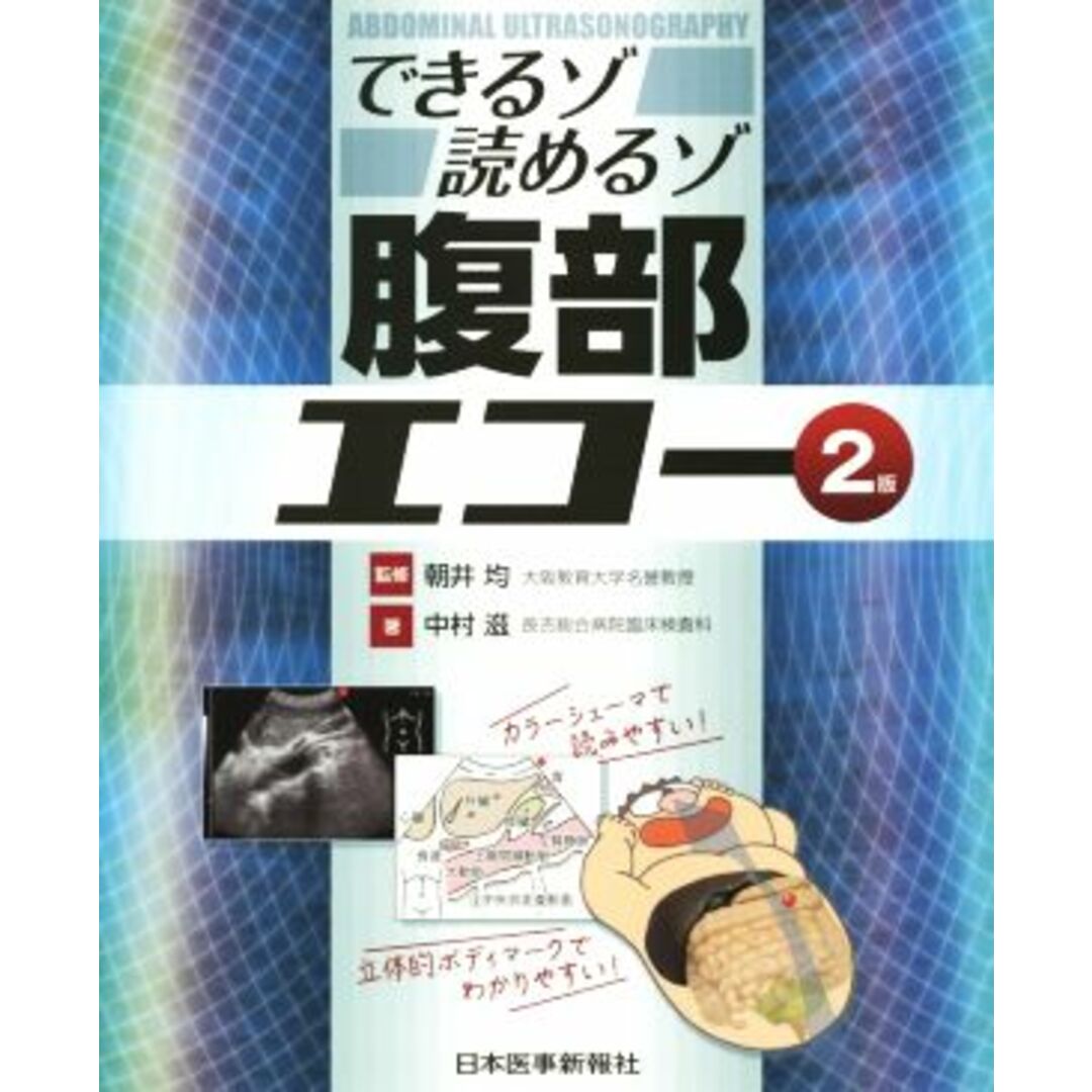 できるゾ読めるゾ腹部エコー　２版／中村滋(著者),朝井均