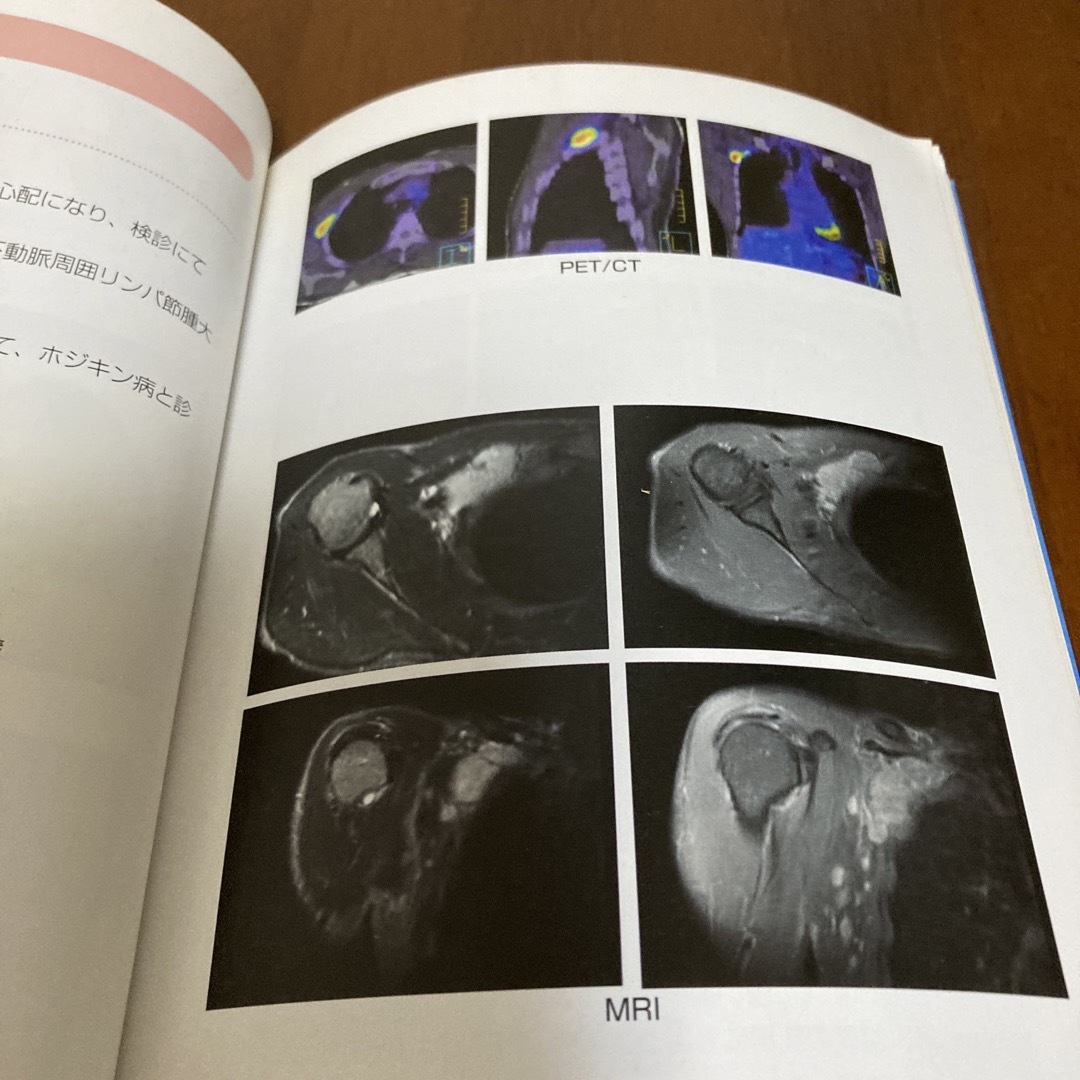 ①ＰＥＴ検査 痛みのない画像検査で、健康に生きる エンタメ/ホビーの本(健康/医学)の商品写真