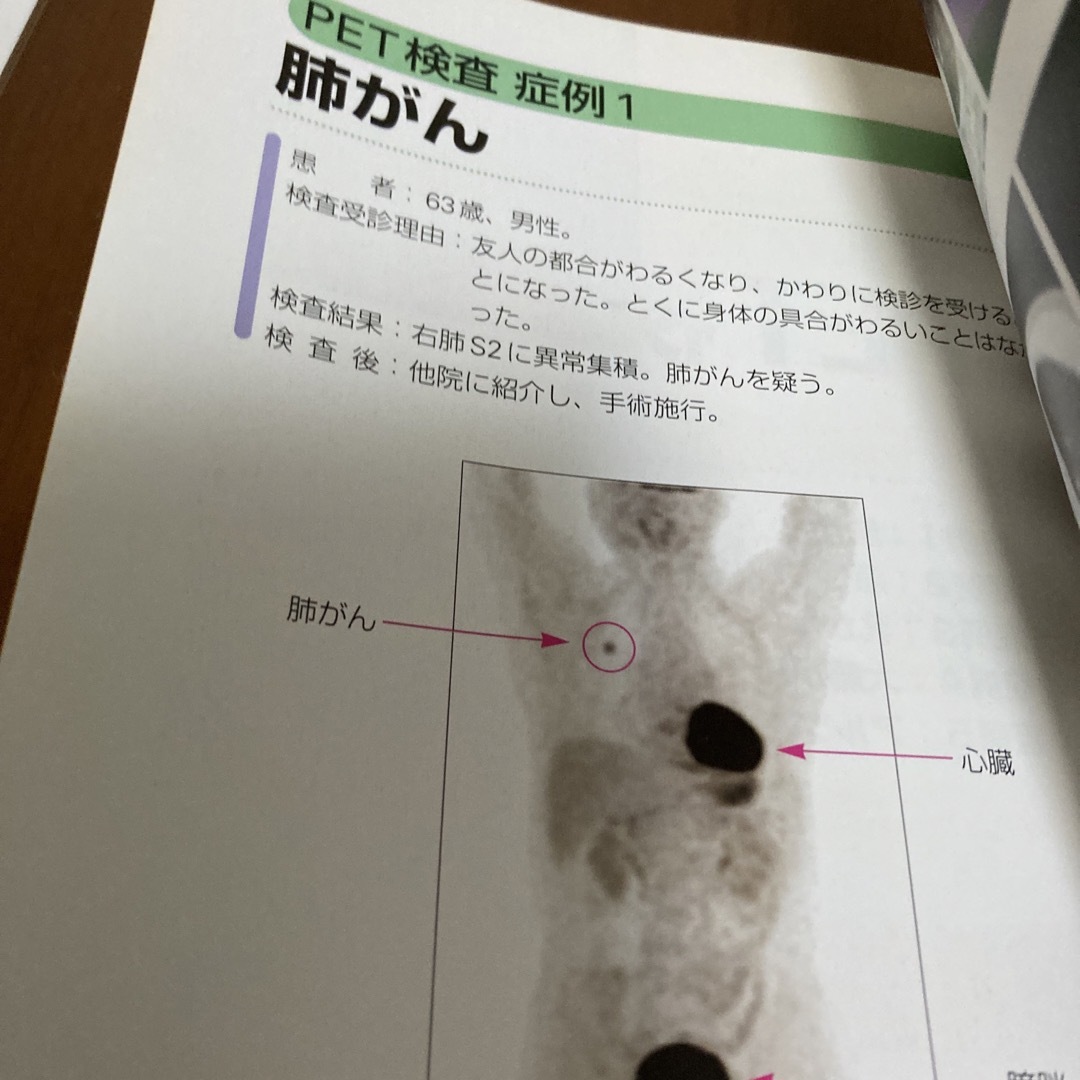 ①ＰＥＴ検査 痛みのない画像検査で、健康に生きる エンタメ/ホビーの本(健康/医学)の商品写真