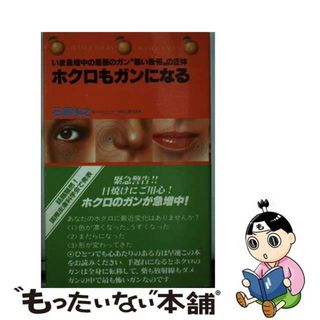 【中古】 ホクロもガンになる/講談社/石原和之(健康/医学)