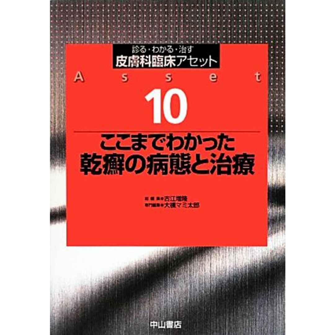 ここまでわかった乾癬の病態と治療 診る・わかる・治す 皮膚科臨床アセット10/古江増隆【総編集】,大槻マミ太郎【専門編集】