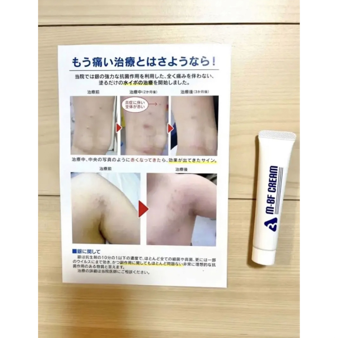 新品未使用 M-BF CREAM 水イボ 水いぼ クリーム 説明用紙付きの通販 by