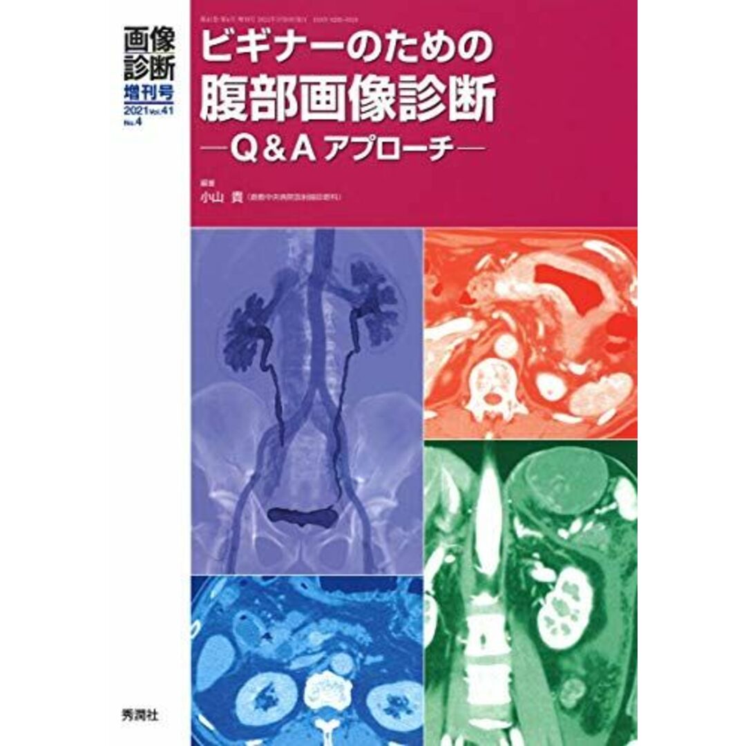 画像診断2021年増刊号(Vol.41 No.4): ビギナーのための腹部画像診断 Q&Aアプローチ (画像診断増刊号)