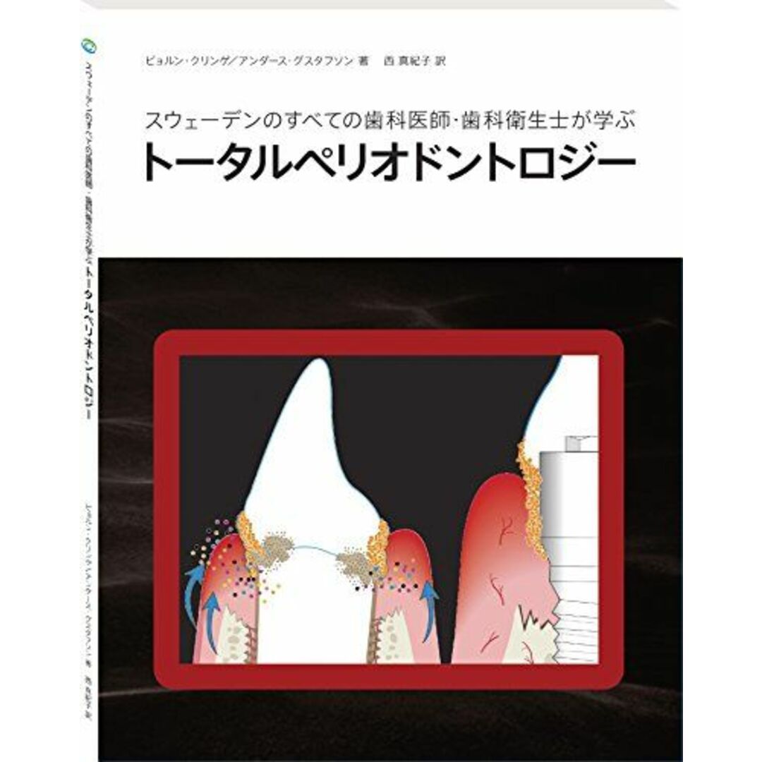 スウェーデンのすべての歯科医師・歯科衛生士が学ぶトータルペリオドントロジー