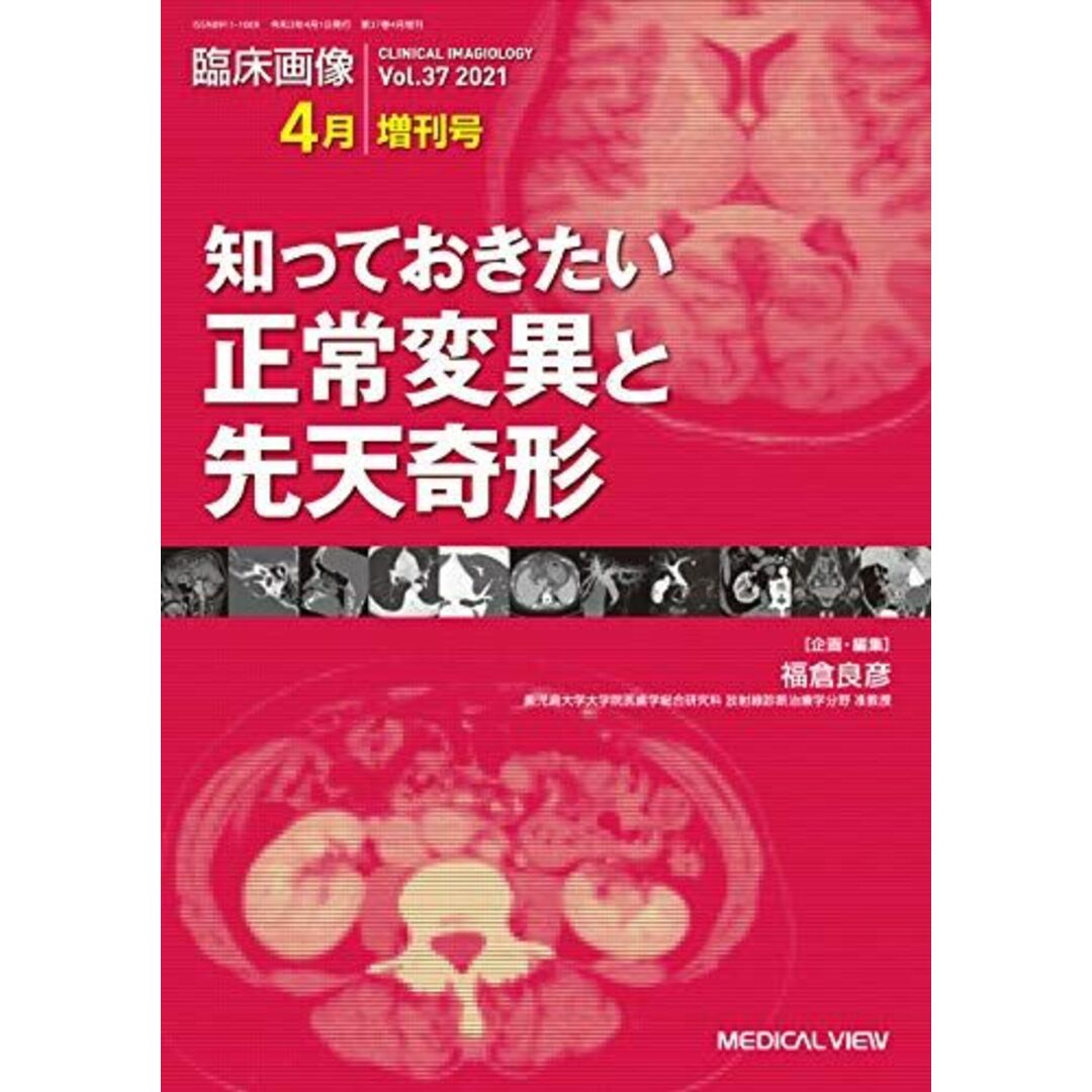 臨床画像 2021年4月増刊号 特集:知っておきたい正常変異と先天奇形