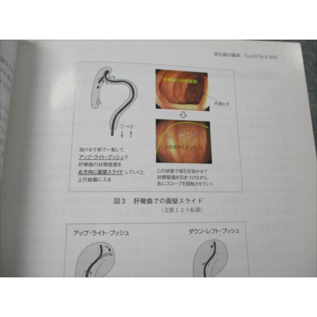 ヴァンメディカル 消化器の臨床 2012年12月/2013年1月 vol.15 No.6 006m3B エンタメ/ホビーの本(健康/医学)の商品写真