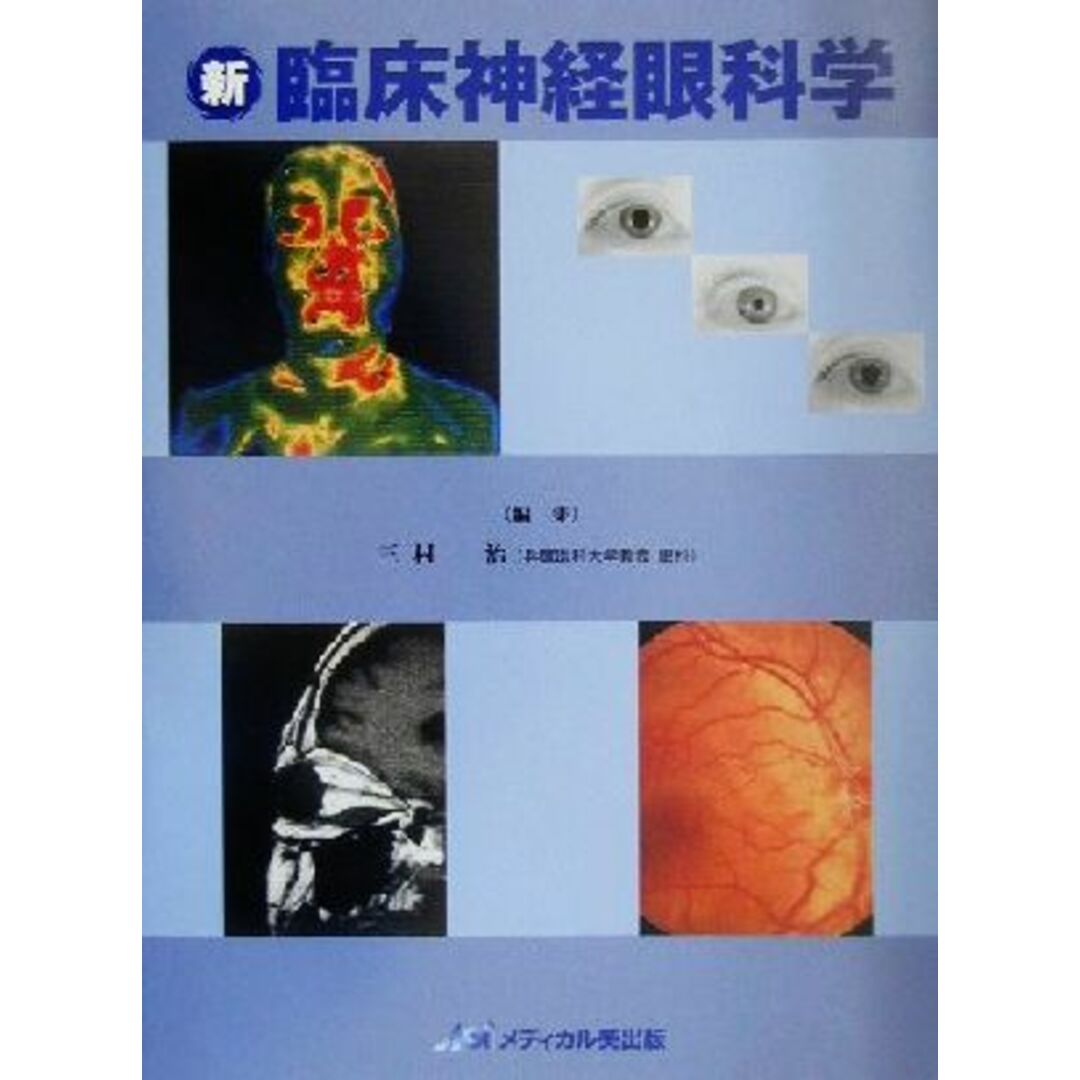 新　臨床神経眼科学／三村治(編者)