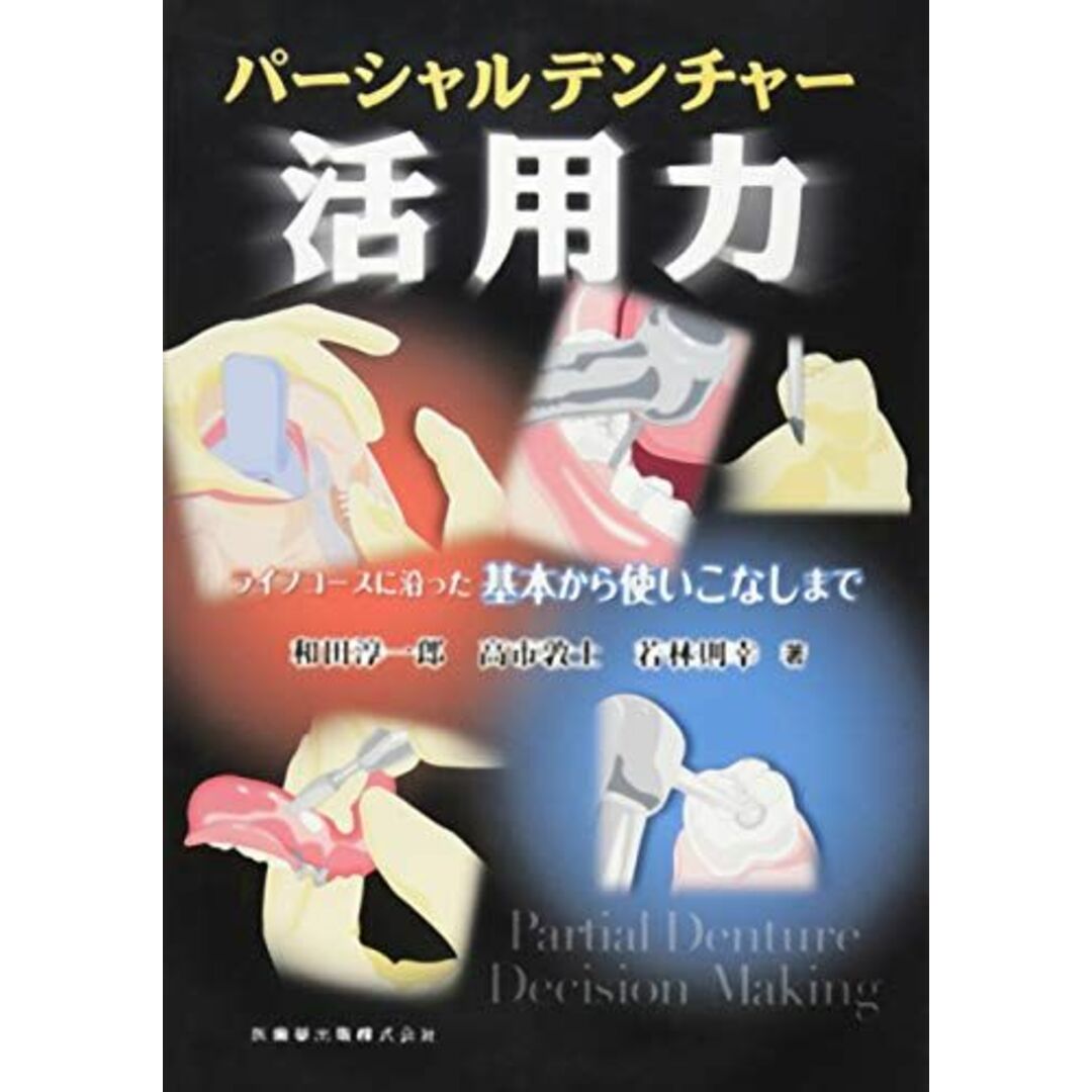 パーシャルデンチャー活用力 ライフコースに沿った基本から使いこなしまで エンタメ/ホビーの本(語学/参考書)の商品写真