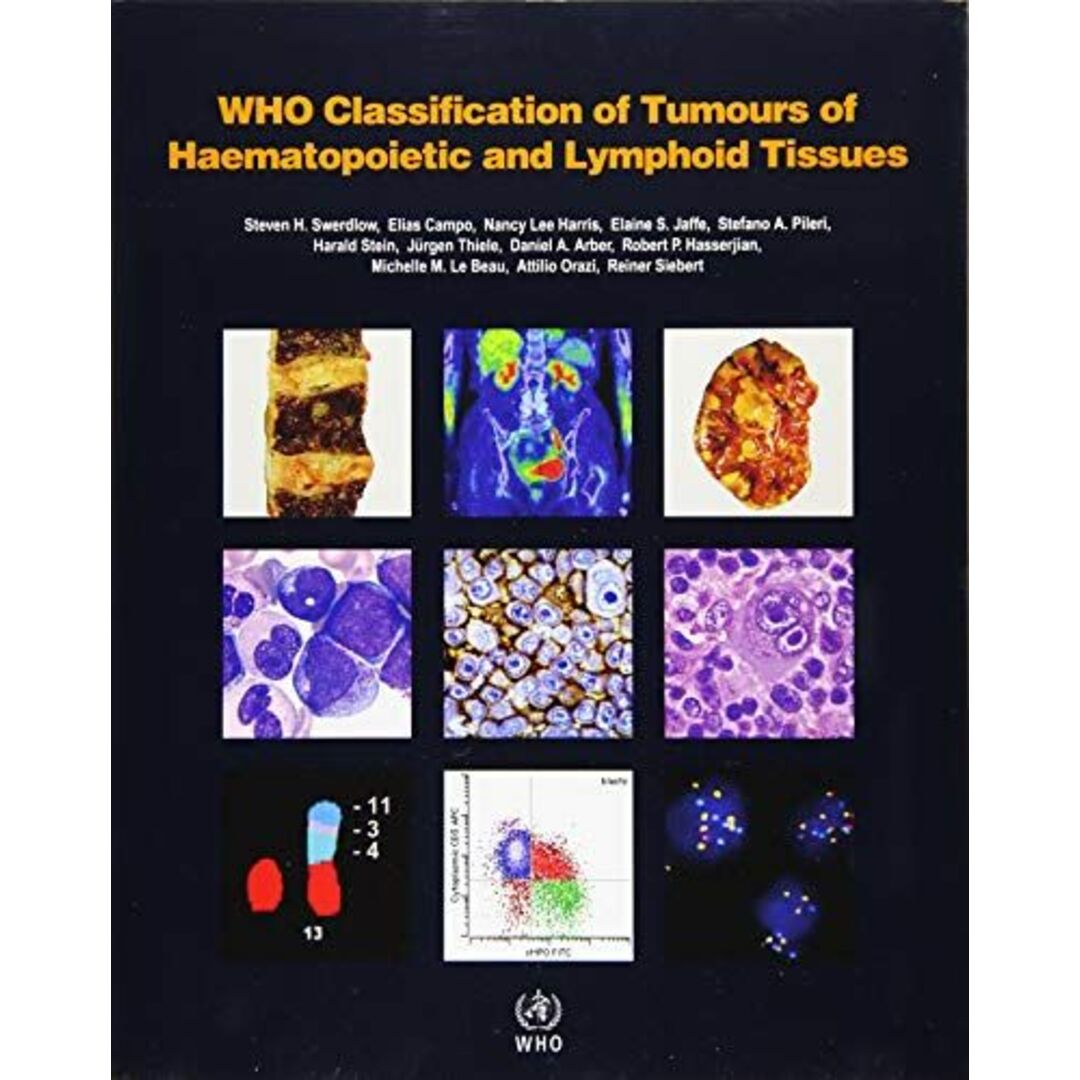 WHO Classification of Tumours of Haematopoietic and Lymphoid Tissues (World Health Organization Classification of Tumours)