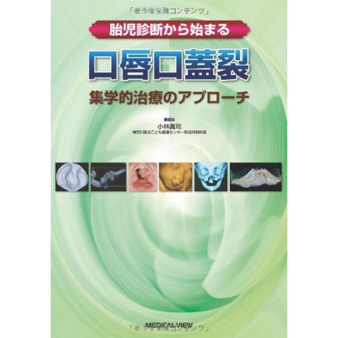 胎児診断から始まる 口唇口蓋裂?集学的治療のアプローチISBN13