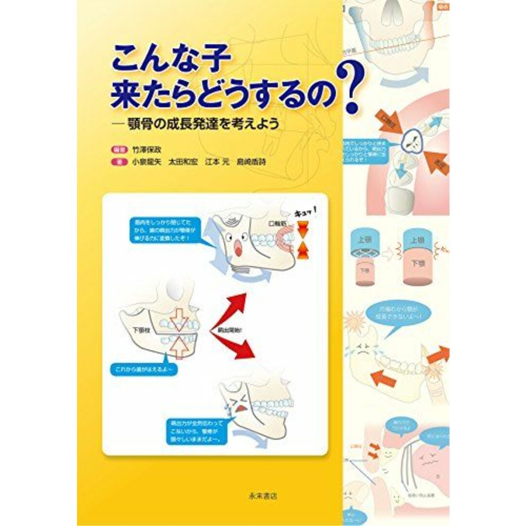 こんな子 来たらどうするの？　―顎骨の成長発達を考えよう