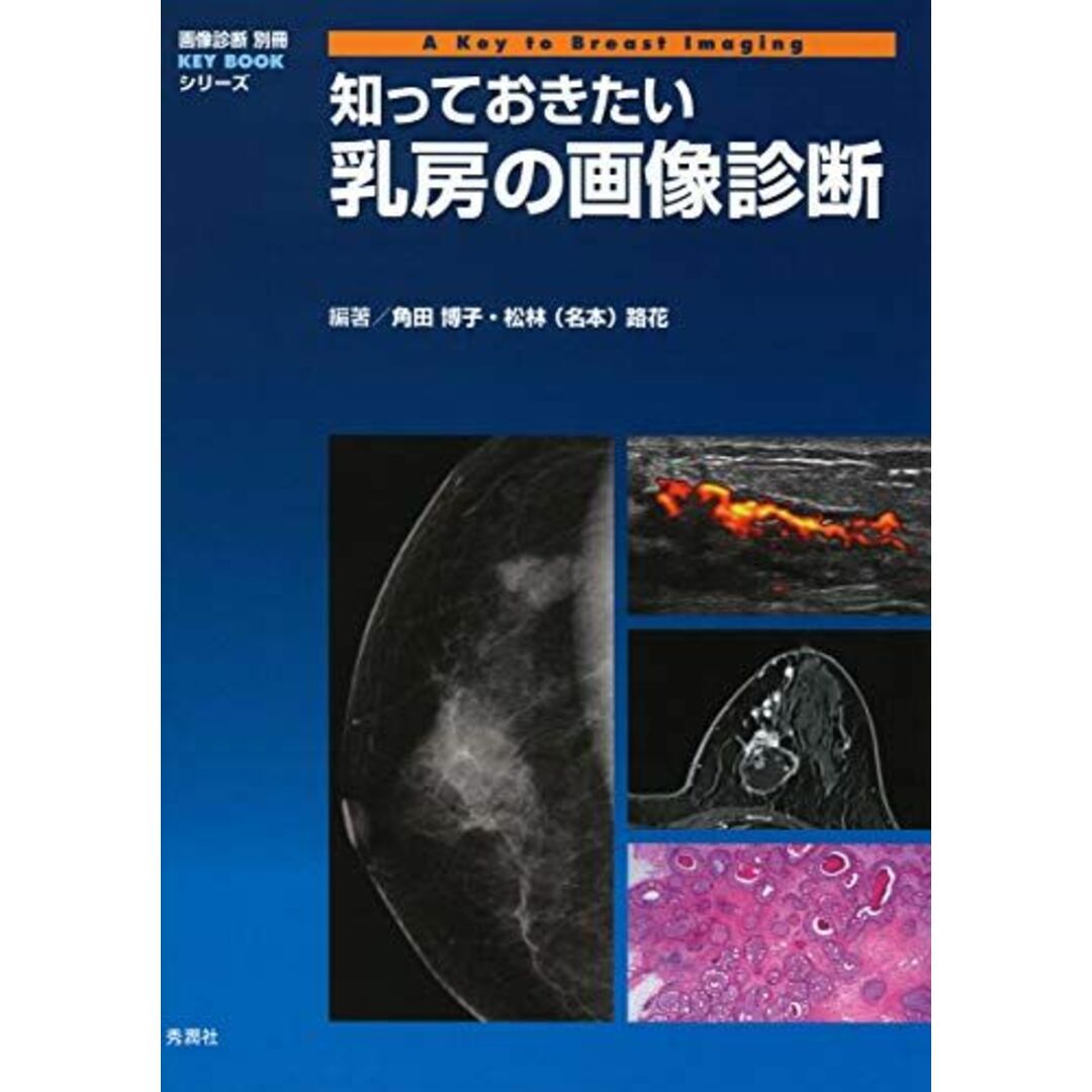 知っておきたい乳房の画像診断 (画像診断別冊KEY BOOKシリーズ)-