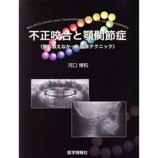 新編 顎関節症 改訂版 日本顎関節学会、 古谷野潔、 和気裕之、 久保田英朗、 小林 馨、 ?木律男、 矢谷博文; 依田哲也