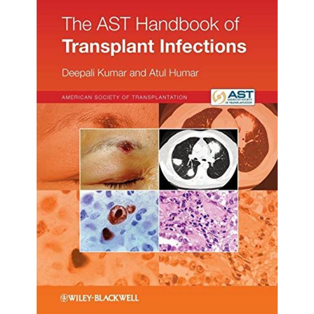 Wiley-BlackwellThe AST Handbook of Transplant Infections [ペーパーバック] Kumar